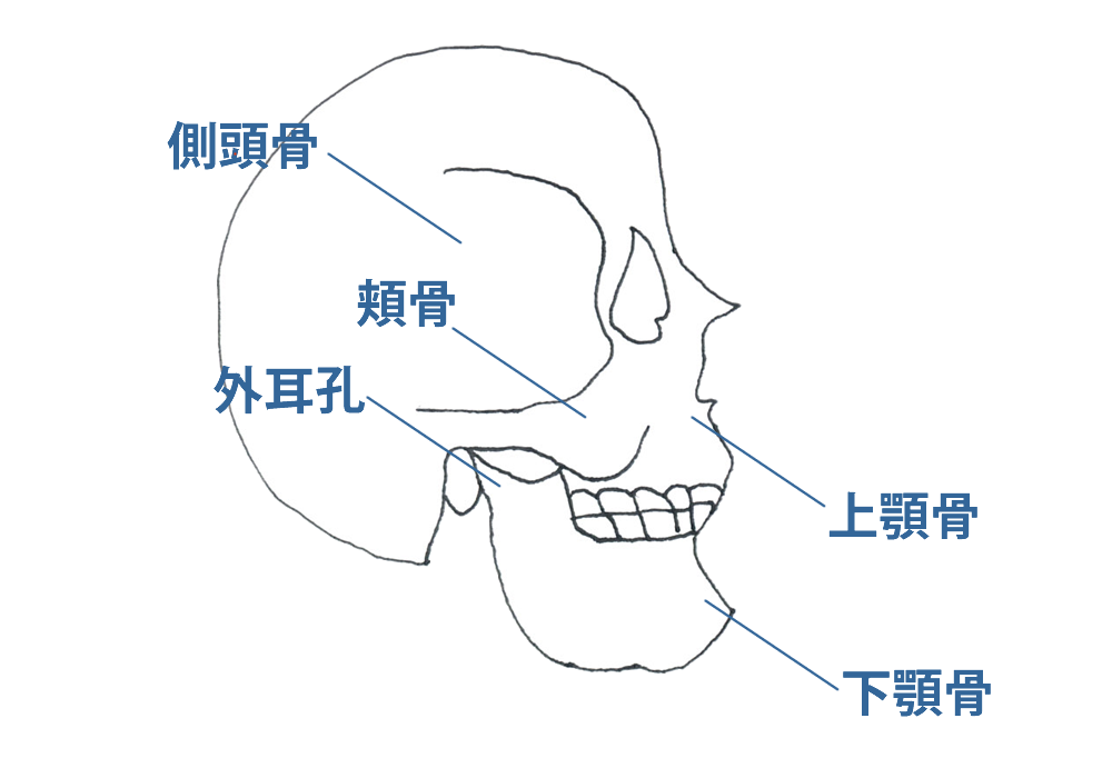 筋肉まわりの障害（Ⅰ型）